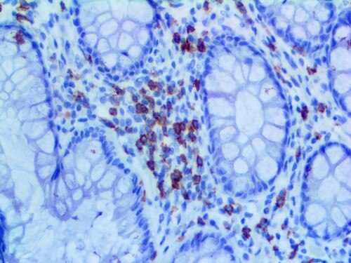 IHC of CD6 on an FFPE Colon Tissue