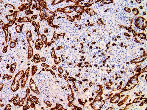 IHC of CD8 on an FFPE Spleen Tissue