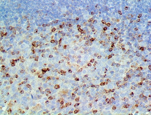 IHC of CTLA-4 / CD152 on an FFPE Tonsil Tissue