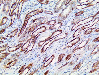 Fumarate Hydratase Antibody Immunohistochemistry on an FFPE Kidney Tissue