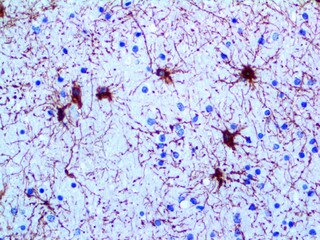 GFAP Antibody Immunohistochemistry on an FFPE Brain Tissue