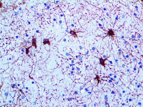GFAP Antibody Immunohistochemistry on an FFPE Brain Tissue