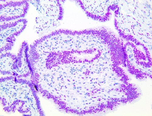 IHC of PolyDetector HRP Fuchsia staining on a FFPE Fallopian Tube Tissue