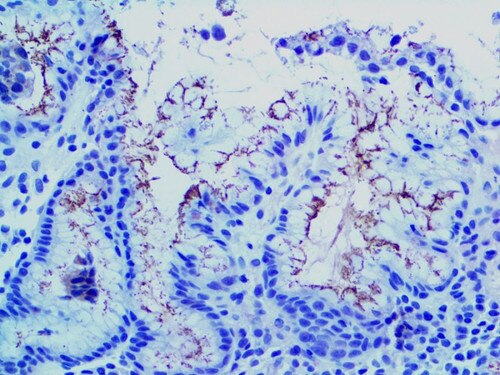 Helicobacter pylori Antibody Immunohistochemistry on an FFPE Stomach Tissue