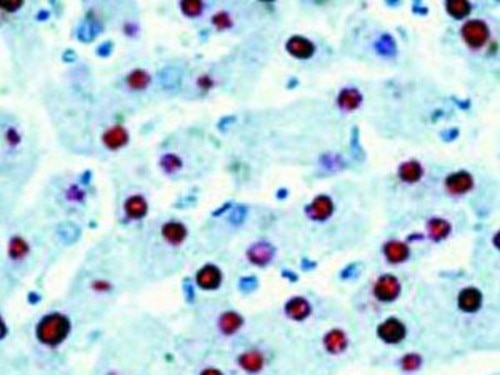 IHC of HBcAG (Hepatitis B) on an FFPE Infected Liver Tissu