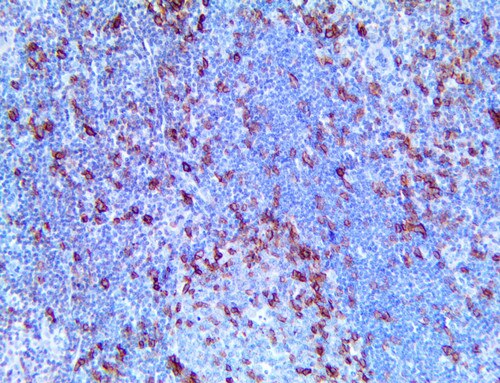 HC of ICOS/CD278 on a FFPE Tonsil Tissue