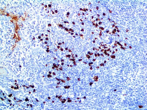 IHC of IgA on a FFPE Tonsil Tissue