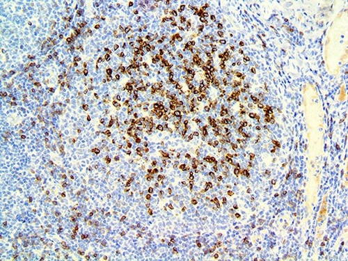 IHC of IgD on a FFPE Tonsil Tissue