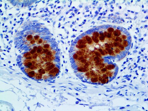 IHC of MUC2 Rmab on an FFPE Colon Tissue