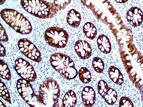 IHC of MUC4 on an FFPE Colon Tissue