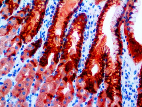 IHC of MUC5AC on an FFPE Stomach Tissue