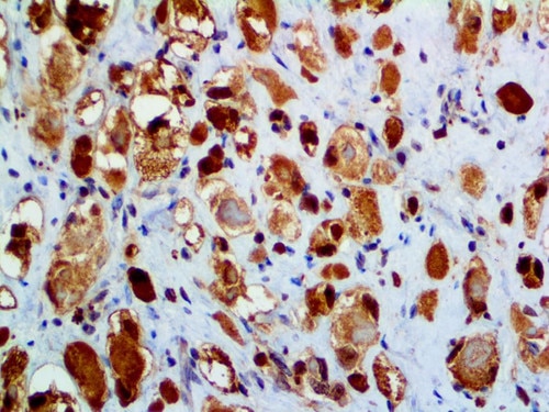 IHC of Myoglobin Rpab on an FFPE Skeletal Muscle Tissue