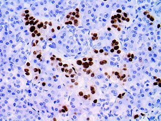IHC of NKX2.2 on an FFPE Pancreas Tissue