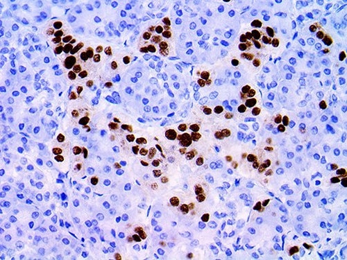 IHC of NKX2.2 on an FFPE Pancreas Tissue