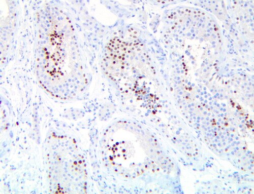IHC of NUTM1/NUT on a FFPE Testis Tissue