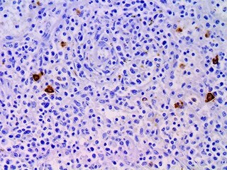 IHC of Neutrophil Elastase on an FFPE Spleen Tissue