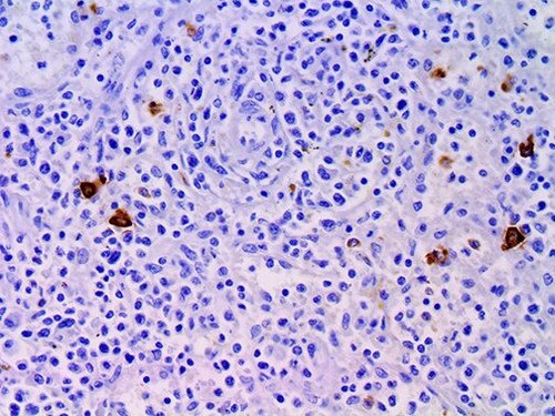 IHC of Neutrophil Elastase on an FFPE Spleen Tissue