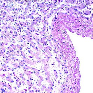 PAS Stain Kit (Diastase)