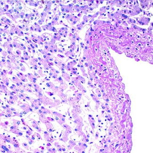 PAS Stain Kit (Diastase)