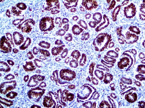 IHC of PAX-2 on an FFPE Kidney Tissue