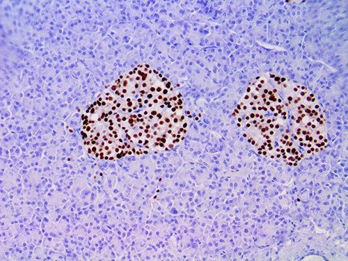 IHC of PAX-6 on an FFPE Pancreas Tissue