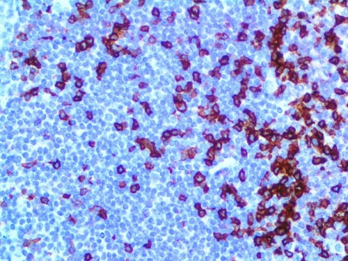 IHC of PD-1 on an FFPE Tonsil Tissue