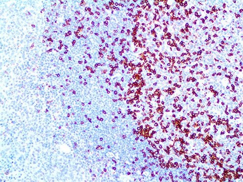 IHC of PD-1 / CD279 on an FFPE Tonsil Tissue