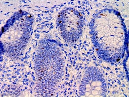 IHC of PDX1 on an FFPE Colon Tissue