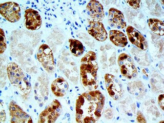 IHC of Parvalbumin on a FFPE Kidney Tissue