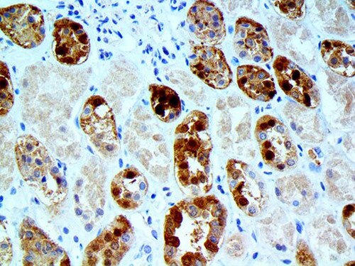 IHC of Parvalbumin on a FFPE Kidney Tissue