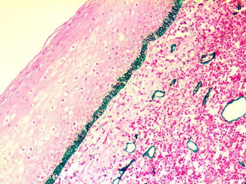 IHC of Podoplanin / D2-40 on an FFPE Tonsil Tissue