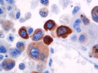 IHC of Prolactin on an FFPE Pituitary Tissue