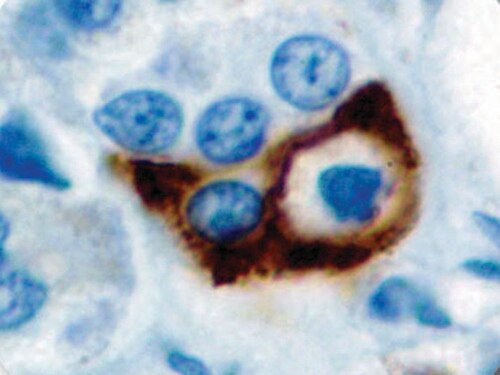 IHC of Prolactin on an FFPE Pituitary TissueMmab