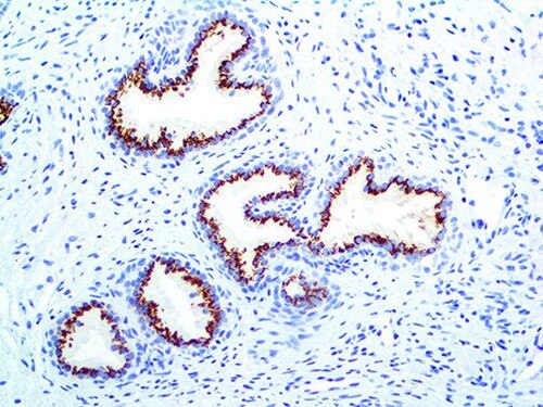 IHC of Prostein on an FFPE Prostate Tissue