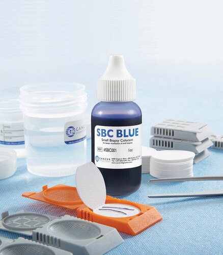 SBC Blue, Small Biopsy Colorant in the lab