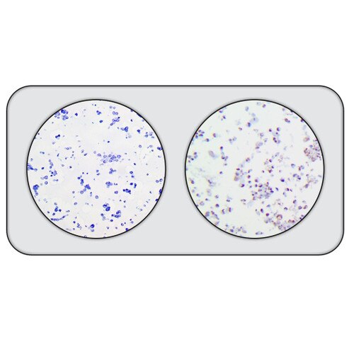 2-Core SV-40 Cell Line Microarray