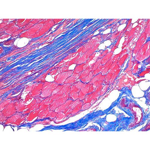 Trichrome Massons Stain Kit on Collagen Muscle