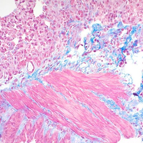 Trichome Massons Stain Kit on Mouse Lung 200x