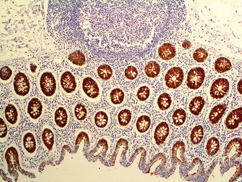 IHC of Villin on an FFPE Colon Tissue