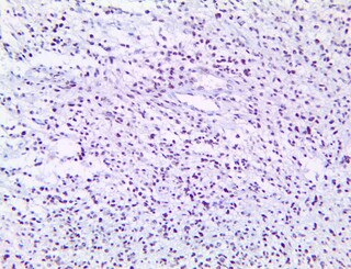 HC of ZFAND3 on a FFPE Glioblastoma Tissue