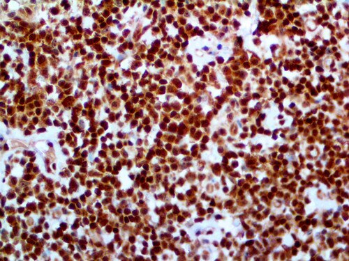 IHC of Bcl-10 on an FFPE Tonsil Tissue