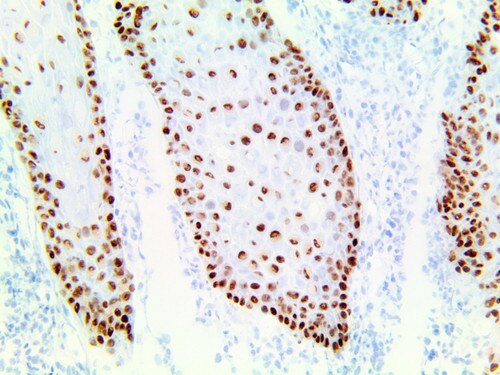 IHC of Mohs PolyDetector Plus DAB HRP Brown Detection System staining